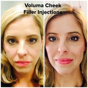 Daytona Beach Microblading, Port Orange Microblading, Daytona Beach Botox, Daytona Beach Filler, Botox Plastic Surgeon Daytona Beach