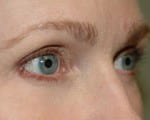 Facelift Daytona Beach, Eyelid Surgery Daytona Beach, Plastic Surgeon Daytona Beach Eyelift, Bleph Surgery Port Orange, Blepharoplasty Surgeon Daytona Beach, Eyelid Lift, Facelift Daytona Beach, Ormond Beach Eyelift and Facelift, Board Certified Plastic Surgeon Daytona Beach, Dr. Samson Facelift Reviews