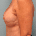 Daytona Beach Reconstruction Surgeon, Best Daytona Beach Reconstruction Surgeon, Top Rated Reconstruction Surgeon Daytona Beach