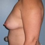 Daytona Beach Reconstruction Surgeon, Best Daytona Beach Reconstruction Surgeon, Top Rated Reconstruction Surgeon Daytona Beach