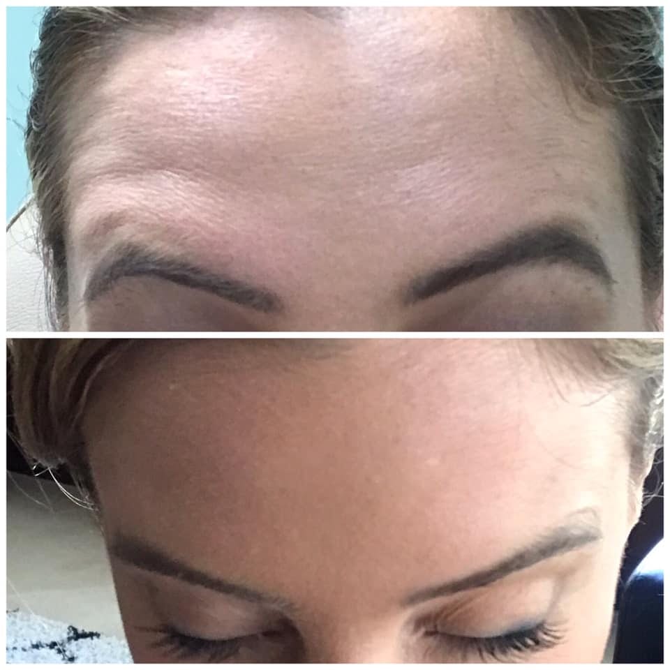 walk in botox bar