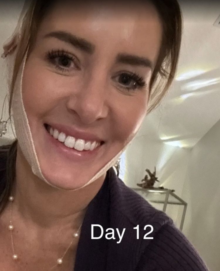 Recovery photos from day 12
